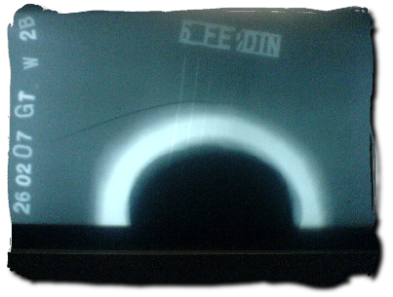 radiography_examples